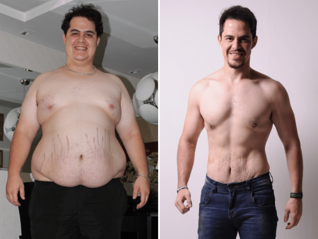 Thiago contrariou médico e secou 76 kg sem cirurgia: "Meta era 1 kg por vez"