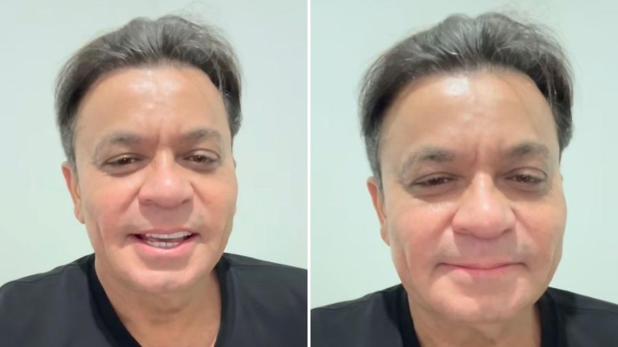 Frank Aguiar afirma que rejuvenesceu após a nova harmonização facial  - Reprodução/Instagram