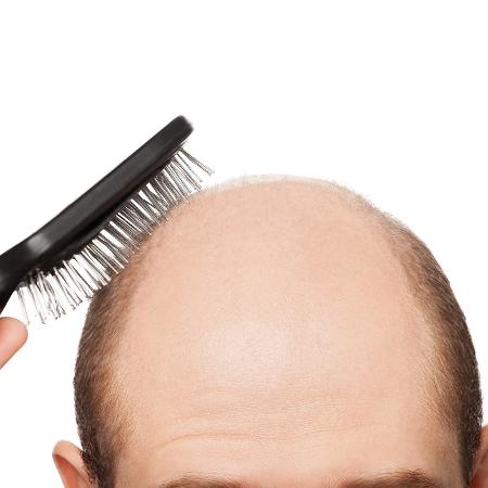 Raspar o cabelo pode prejudicar o crescimento - iStock