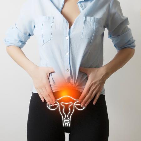 Exames ginecológicos são capazes de detectar precocemente doenças graves, como câncer do colo do útero - Istock 