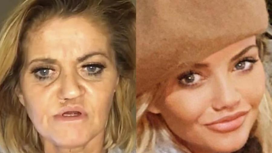 A atriz Danniella Westbrook antes e depois de procedimentos - Reprodução/Instagram
