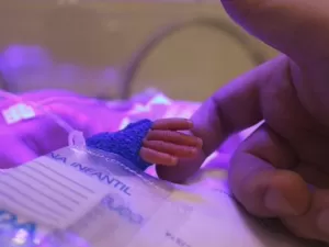 Vida na UTI neonatal: 'Tive gêmeos prematuros; meu filho nasceu com 695 g'