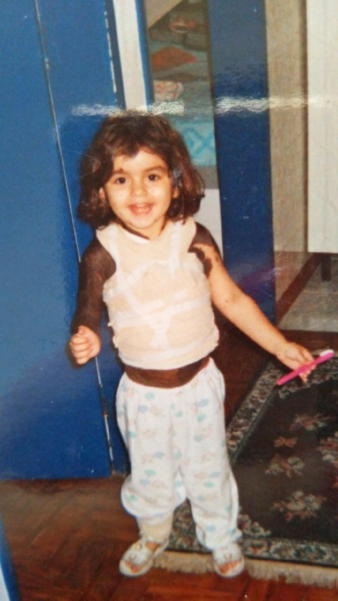 Após passar por mais de 30 cirurgias, ela decidiu parar de tentar novos procedimentos. - HotSpot Midia