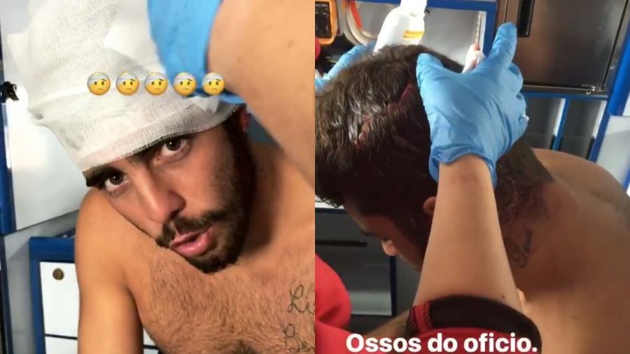 Pedro Scooby abre a cabeça ao ser atingido por prancha enquanto surfava em Portugal - Reprodução/Instagram