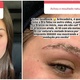 Flávia Pavanelli mostra retirada de micropigmentação - Instagram