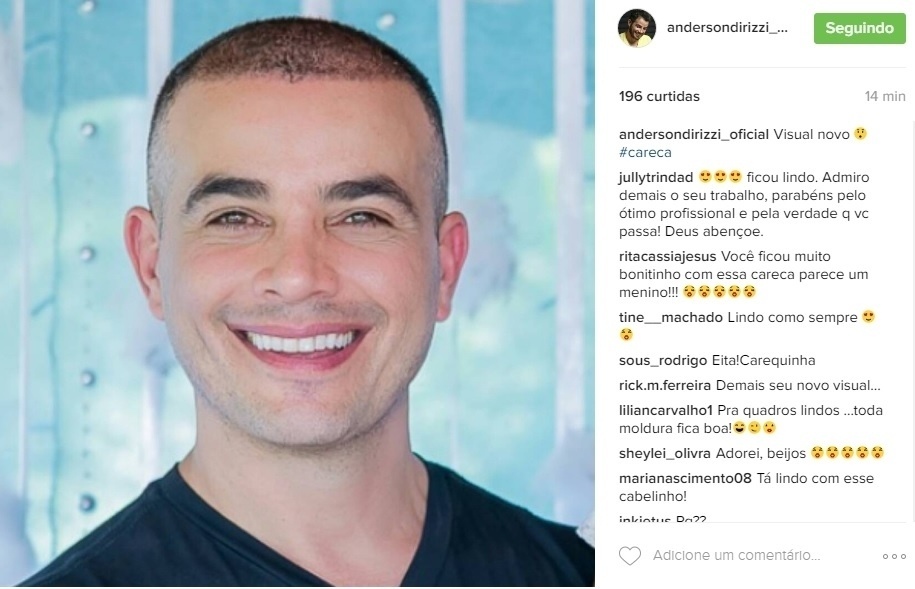 24.out.2016 -Anderson Di Rizzi muda o visual e mostra a transformação em sua conta do Instagram. "Visual novo. Careca", escreveu ele. O ator, cujo último papel foi como o Zé dos Porcos de "Êta Mundo Bom", recebeu elogio das fãs. "Você ficou muito bonitinho com essa careca parece um menino!, falou uma internauta. "Lindo de todo jeito", disse outra - Reprodução/Instagram/andersondirizzi_oficial
