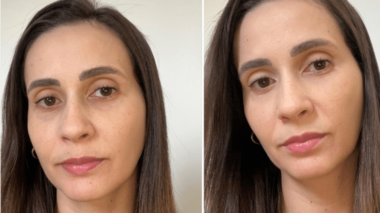 Antes e depois do uso do corretivo Antes e depois do uso do corretivo