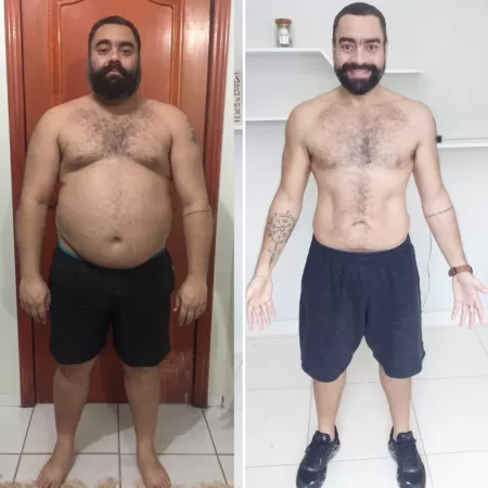 Ex-obeso mórbido, Lucas perdeu 40 kg sem gastar muito com dieta