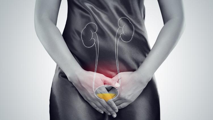 Mulher com infecção urinária, sistema urinário, geniturinário Mulher com infecção urinária, sistema urinário, geniturinário