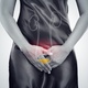 Mulher com infecção urinária, sistema urinário, geniturinário - iStock - iStock