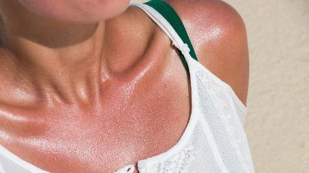 Jovem exagerando no sol - Getty Images - Getty Images