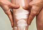 Osteoporose masculina: a doença silenciosa que causa fraturas em milhares de homens todos os anos - GETTY IMAGES
