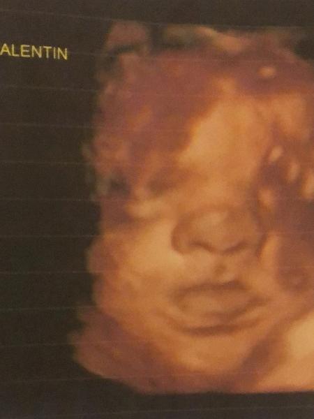 Carol Dantas mostra rostinho do filho em ultrassom - Reprodução/Instagram