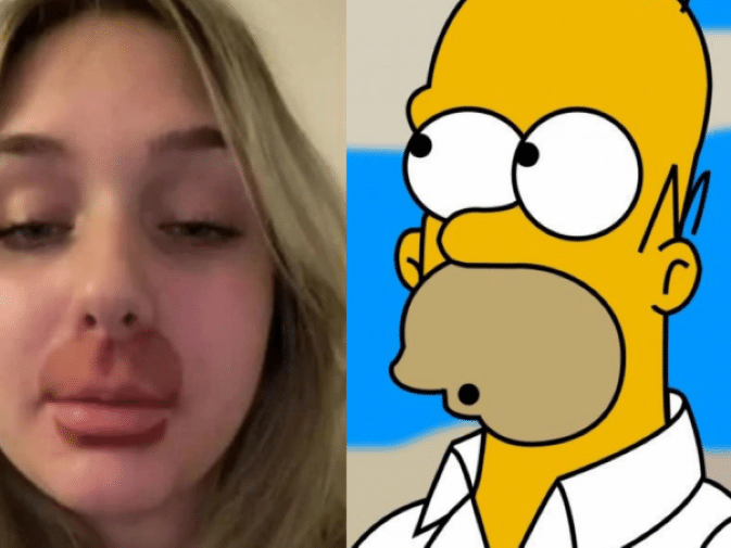 O CARA USA Akano FOTO DER PERFIL DE SIMPSONS E AINDA QUER