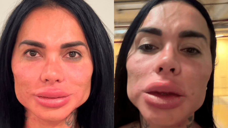 Kamila Simioni surpreende ao mostrar resultado de harmonização facial - Instagram