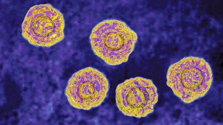 Изображение на вируса на хепатит С - BSIP/Contributor Getty Images - BSIP/Contributor Getty Images