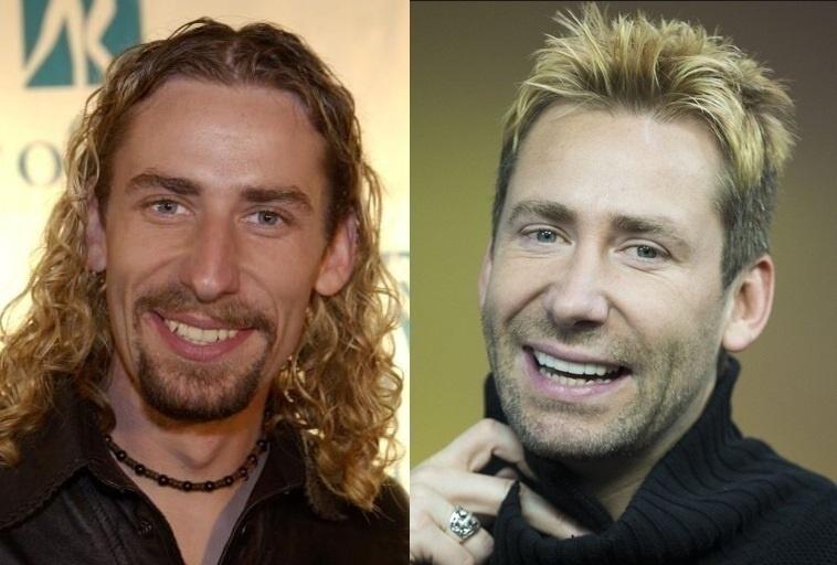 Antes e depois de Chad Kroeger - Montagem/Reprodução
