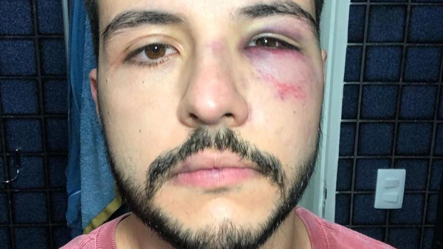 Matheus Ribeiro, jornalista da Record TV, foi agredido em uma tentativa de roubo - Reprodução/Instagram