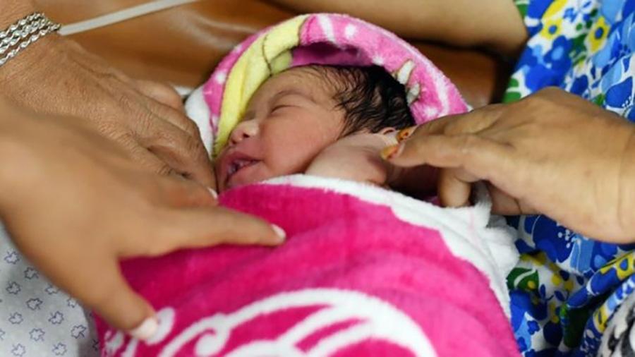 Cesarianas podem salvar vidas, mas também podem trazer riscos desnecessários para mãe e criança - Getty Images