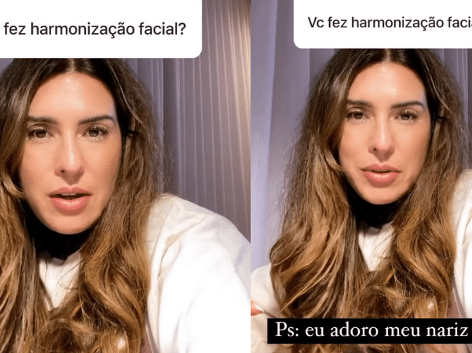 Fernanda Paes Leme nega ter feito harmonização facial