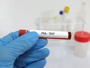 Próstata: será que homens acima de 50 não deveriam fazer o exame de PSA?