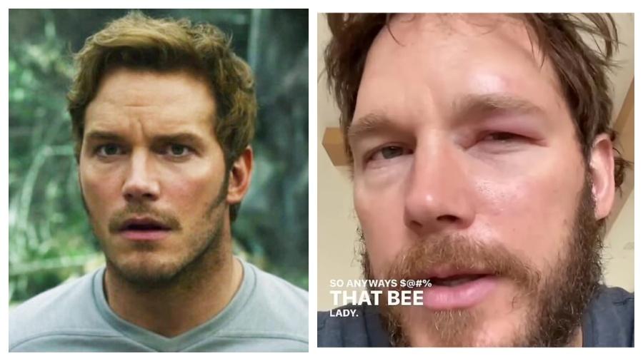 Chris Pratt ficou com o olho inchado após ser picado por abelha - Reprodução