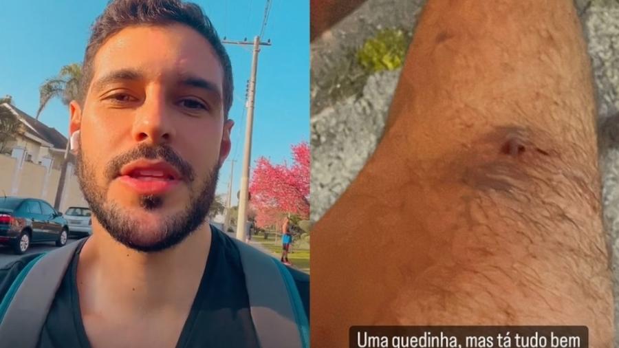 Rodrigo Mussi mostra joelho ralado após queda de bicicleta - Reprodução/Instagram