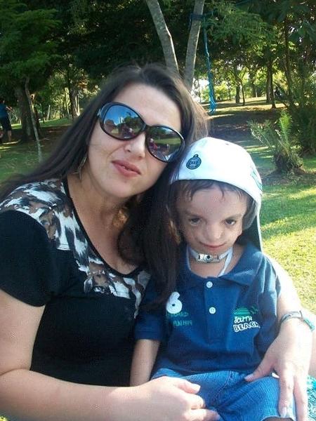 Sandra com o filho Marcel, portador da síndrome Treacher Collins - Arquivo pessoal