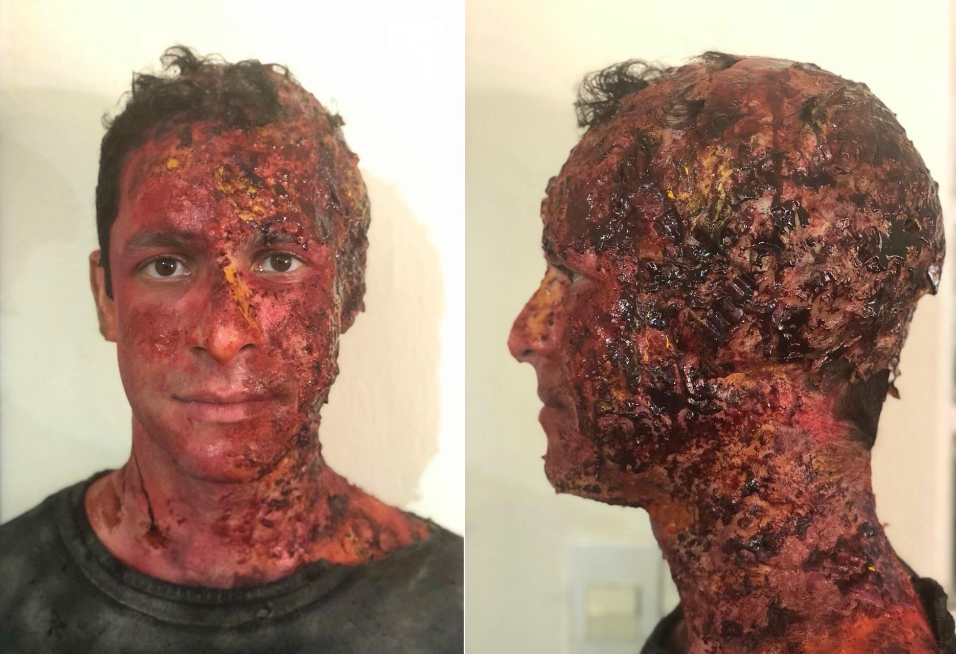 Rainer Cadete aparecerá irreconhecível para viver um bandido na segunda temporada da série "Carcereiros", que estreia na Globo em outubro. Ele desfigurou o rosto e sentiu náuseas ao se ver completamente diferente para seu próximo trabalho na TV. - Montagem/UOL/Divulgação