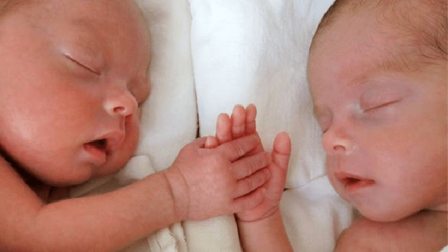 Especialistas explicam que o raro fenômeno "feto in fetus" acontece quando o óvulo fecundado se divide depois da segunda semana e não na primeira, como acontece no caso de gêmeos idênticos - Getty Images