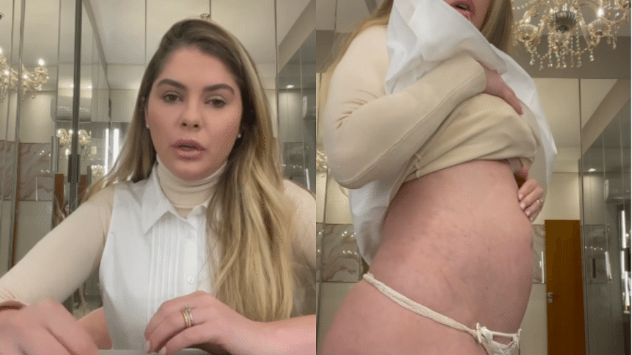 Bárbara Evans mostrou o inchaço do corpo em meio ao tratamento da fertilização in vitro - Reprodução/Instagram