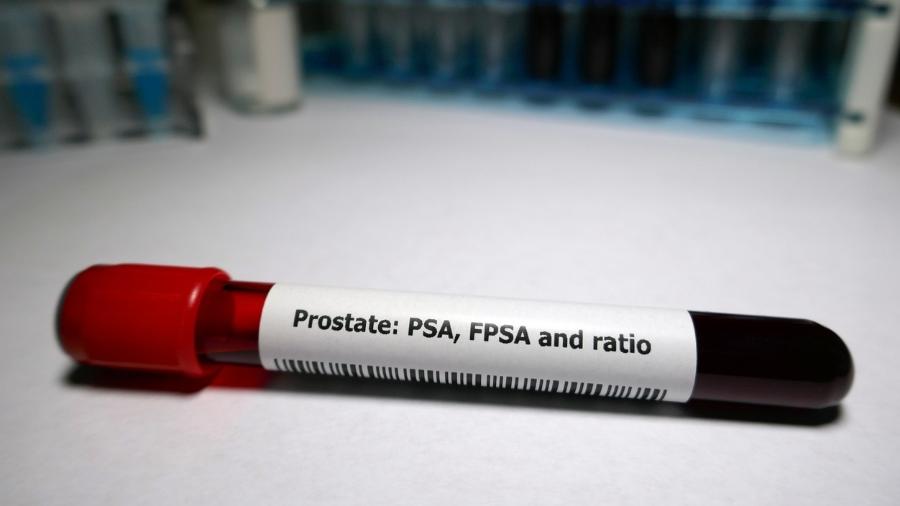 Exame rápido de PSA já pode ser feito em farmácias - iStock