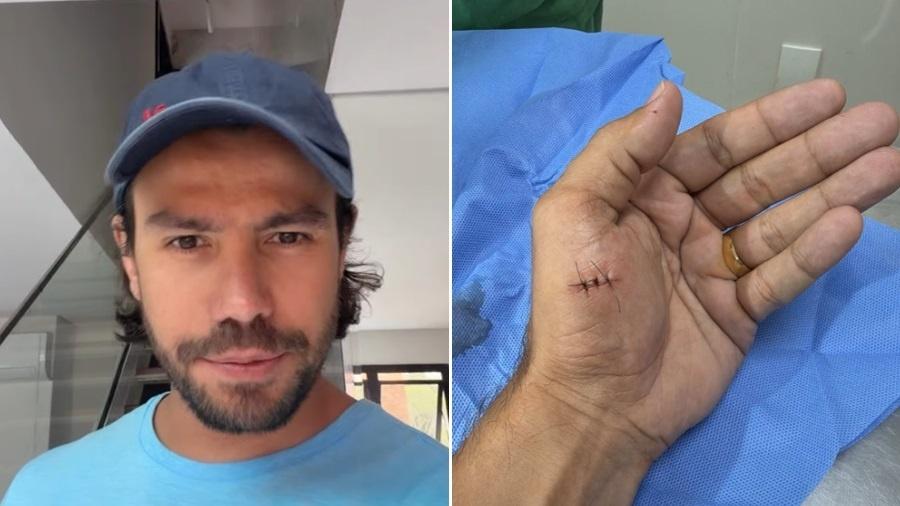 Mariano leva pontos na mão esquerda