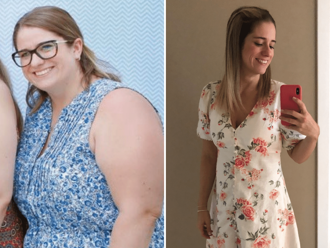 "Perdi 45 kg ao tratar meu vício em comida e me apaixonei por exercícios"
