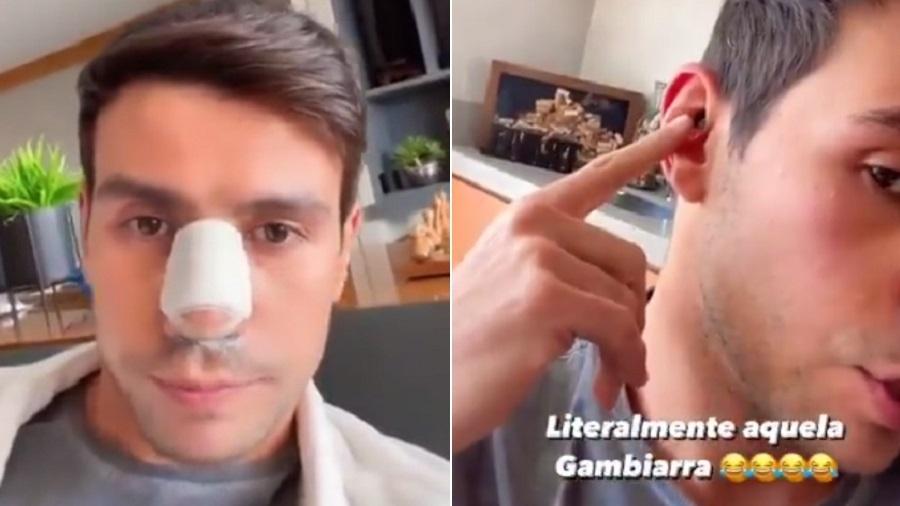 Mariano retira cartilagem da orelha para operar o nariz - Reprodução/Instagram