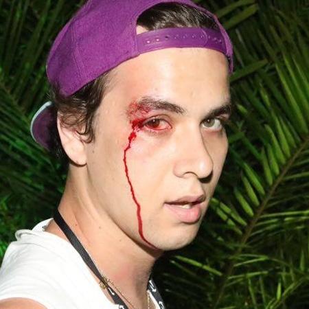 Fotógrafo ficou com o rosto sangrando após agressão - Ali Karakas/Divulgação - Ali Karakas/Divulgação