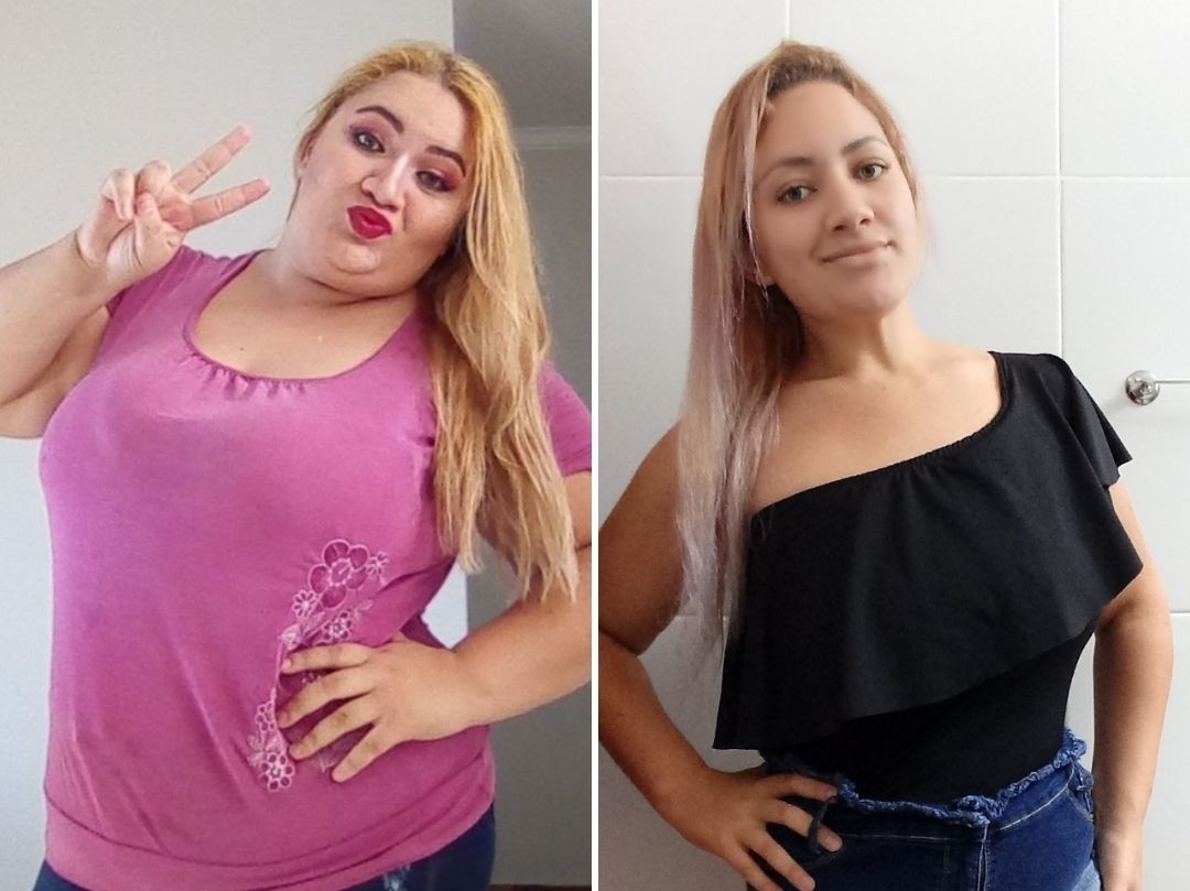 Gabriely teve compulsão alimentar e perdeu 70 kg após dieta