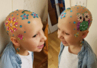 Garota participa do "Dia do Penteado Maluco" mesmo sem ter fios na cabeça - Reprodução/Instagram
