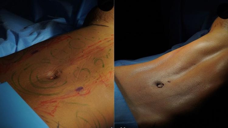 Lorena Maria: antes e depois Lorena Maria: antes e depois