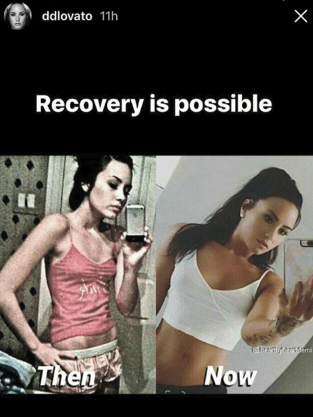Demi Lovato antes e depois - Reprodução/Instagram @ddlovato - Reprodução/Instagram @ddlovato