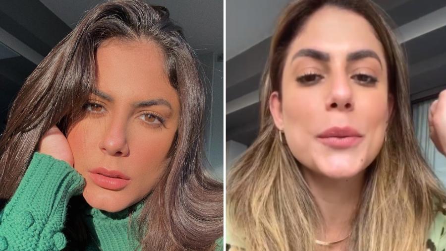 Mari Gonzalez, antes e depois do preenchimento labial - Reprodução/Instagram