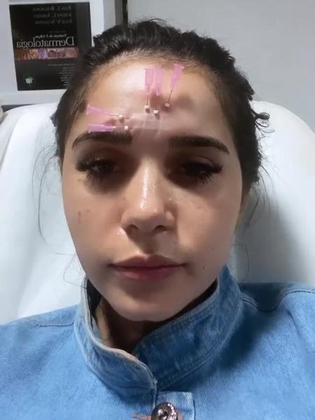 Gizelly mostrou detalhes dos procedimentos no Instagram Gizelly mostrou detalhes dos procedimentos no Instagram