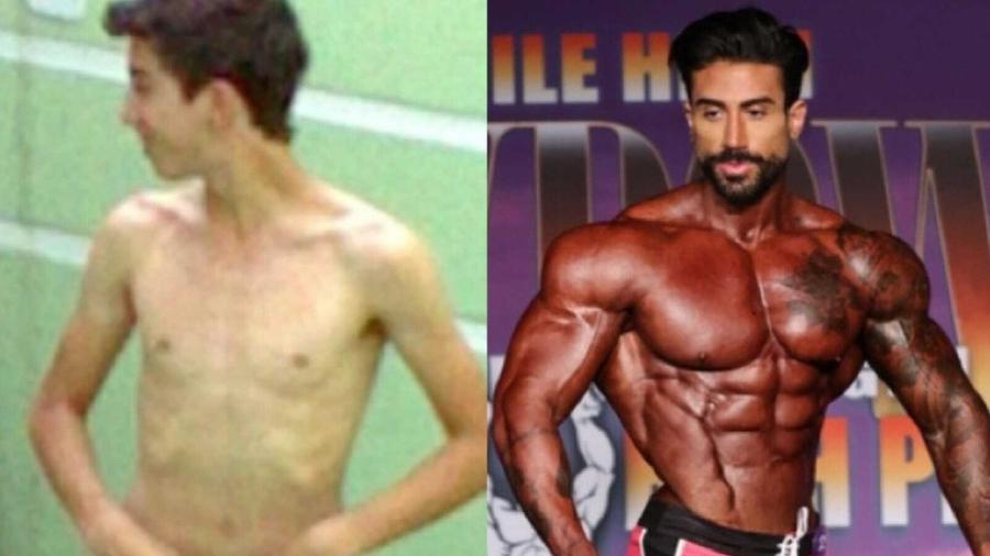 Antes e depois de Diogo Basaglia