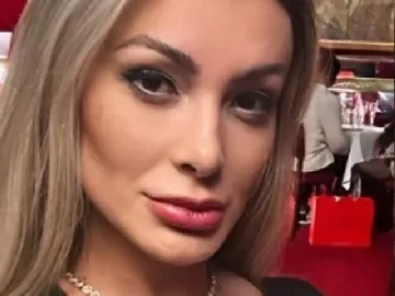 Andressa Urach assusta fãs ao aparecer sem os dentes nas redes sociais