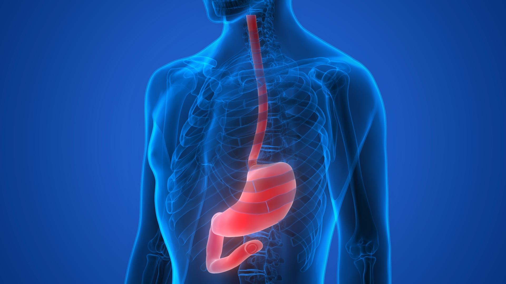 Câncer de estômago: saiba as causas, sintomas e como tratar o tumor