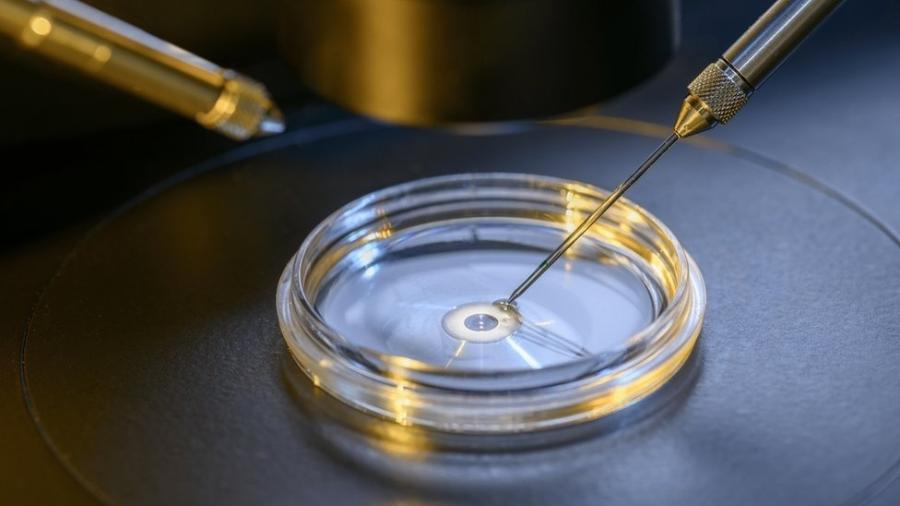 Pesquisa conseguiu fazer com que óvulos passassem pelo processo de maturação em laboratório - Getty Images