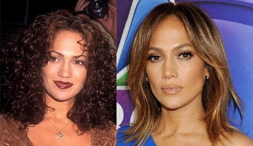 Antes e depois de Jennifer Lopez - Montagem/Reprodução