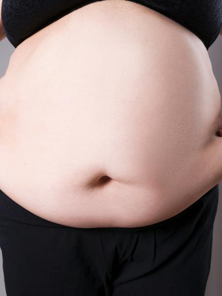 Bariátrica - iStock - iStock