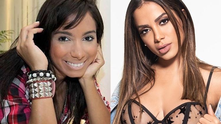 O antes e depois de Anitta passou por várias transformações