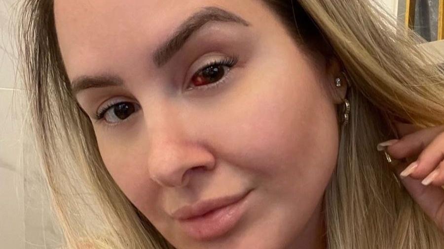 Patrícia Leitte contou que está com um derrame ocular - Reprodução/Instagram